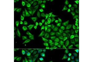 Immunofluorescence analysis of A549 cells using ABAT Polyclonal Antibody (ABAT 抗体)