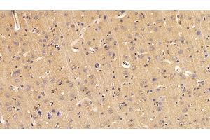 Immunohistochemistry (IHC) image for anti-Adiponectin (ADIPOQ) (AA 111-244) antibody (ABIN7432169)