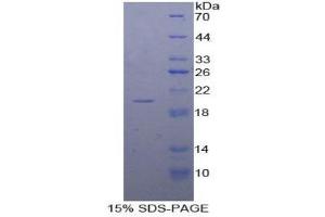 SDS-PAGE (SDS) image for Calmodulin 1 (Calm1) (AA 2-149) protein (His tag) (ABIN1879196)