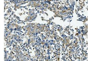 IHC analysis of VPS4B/MIG1 using anti-VPS4B/MIG1 antibody (ABIN7599560).