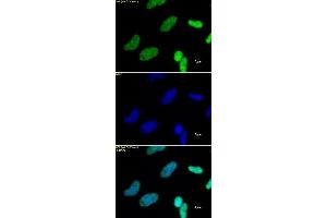 Histone H3K27me3 antibody (pAb) tested by immunofluorescence. (Histone 3 抗体  (H3K27me3))