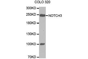 Western blot analysis of extracts of COLO 320 cells lines, using NOTCH3 antibody. (NOTCH3 抗体  (AA 751-850))