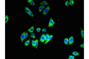 Immunofluorescent analysis of HepG2 cells using ABIN7170223 at dilution of 1:100 and Alexa Fluor 488-congugated AffiniPure Goat Anti-Rabbit IgG(H+L) (SLC35B1 抗体  (AA 106-135))