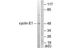 Western blot analysis of extracts from K562 cells, using Cyclin E1 Antibody.