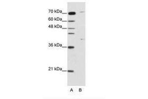 Image no. 1 for anti-Zinc Finger Protein 668 (ZNF668) (C-Term) antibody (ABIN202822) (ZNF668 抗体  (C-Term))