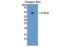 Detection of Recombinant LXRa, Mouse using Polyclonal Antibody to Liver X Receptor Alpha (LXRa) (NR1H3 抗体  (AA 93-432))