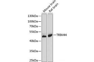 Western blot analysis of extracts of various cell lines using TRIM44 Polyclonal Antibody at dilution of 1:1000. (TRIM44 抗体)