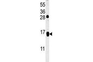 CD69 antibody western blot analysis in HL-60 lysate (CD69 抗体  (AA 119-148))