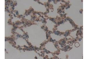Detection of ITGaD in Rat Lung Tissue using Polyclonal Antibody to Integrin Alpha D (ITGaD) (ITGAD 抗体  (AA 879-1099))