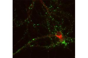 Immunofluorescence labeling of cultured hippocampus neurons (dilution 1 : 1000; red). (Neurobeachin 抗体  (AA 952-1320))