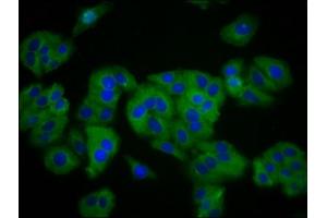 Immunofluorescence staining of HepG2 cells with ABIN7170247 at 1:133, counter-stained with DAPI. (SLC41A1 抗体  (AA 1-96))