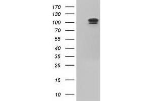 HEK293T cells were transfected with the pCMV6-ENTRY control (Left lane) or pCMV6-ENTRY USP5 (Right lane) cDNA for 48 hrs and lysed. (USP5 抗体)