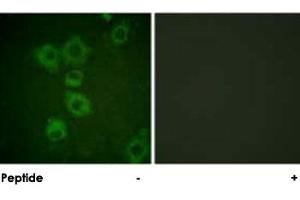 Immunofluorescence analysis of HUVEC cells, using CASP6 polyclonal antibody .