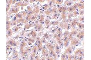 Immunohistochemistry of HTRA2 in human liver tissue with HTRA2 polyclonal antibody  at 2 ug/mL . (HTRA2 抗体  (C-Term))