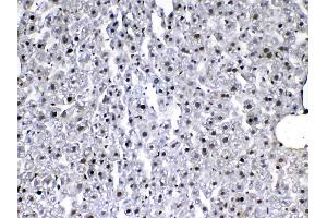 IHC analysis of VEGF Receptor 3 using anti-VEGF Receptor 3 antibody . (FLT4 抗体)