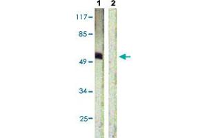 Western blot analysis of Lane 1: HepG2 cells, Lane 2: antigen-specific peptide treated HepG2 cells with ETS1 (phospho T38) polyclonal antibody  at 1:500-1:1000 dilution. (ETS1 抗体  (pThr38))