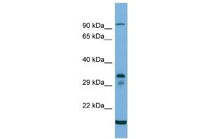 Host:  Rabbit  Target Name:  TM6SF2  Sample Type:  293T Whole cell lysates  Antibody Dilution:  1. (TM6SF2 抗体  (C-Term))