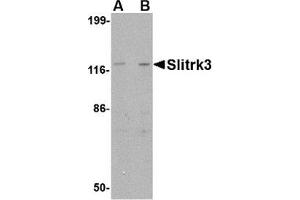 Western blot analysis of Slitrk3 in SK-N-SH cell lysate with AP30802PU-N Slitrk3 antibody at (A) 0. (SLITRK3 抗体  (C-Term))