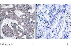 Image no. 1 for anti-Heat Shock 27kDa Protein 1 (HSPB1) (pSer82) antibody (ABIN197004) (HSP27 抗体  (pSer82))