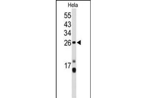 Western blot analysis of CENPH Antibody (Center) (ABIN653160 and ABIN2842728) in Hela cell line lysates (35 μg/lane). (CENPH 抗体  (AA 136-162))