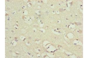 Immunohistochemistry of paraffin-embedded human brain tissue using ABIN7160914 at dilution of 1:100