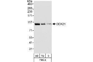 anti-DEAD (Asp-Glu-Ala-Asp) Box Polypeptide 21 (DDX21) (AA 1-50) antibody