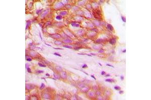 Immunohistochemistry (IHC) image for anti-Fibroblast Growth Factor Receptor 1 (FGFR1) (C-Term), (pTyr766) antibody (ABIN7295658)