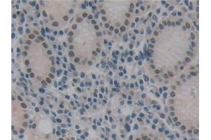 Detection of DFFa in Human Stomach Tissue using Polyclonal Antibody to DNA Fragmentation Factor Subunit Alpha (DFFa)