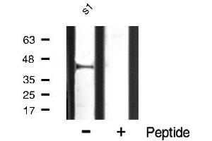 Western blot analysis of p38 MAPK expression in hela whole cell lysates,The lane on the right is treated with the antigen-specific peptide.