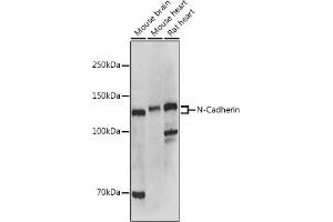 Western blot analysis of extracts of various cell lines, using N-Cadherin antibody (ABIN1684127, ABIN1514384, ABIN5663657 and ABIN6213846) at 1:500 dilution. (N-Cadherin 抗体  (AA 450-550))