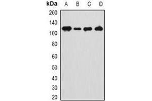 Western blot analysis of ANKRD28 expression in Hela (A), HT1080 (B), mouse kidney (C), mouse testis (D) whole cell lysates. (ANKRD28 抗体)