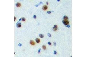 Immunohistochemical analysis of NPAS4 staining in human brain formalin fixed paraffin embedded tissue section. (NPAS4 抗体  (C-Term))