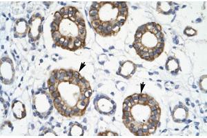 Human kidney; RFP2 antibody - middle region in Human kidney cells using Immunohistochemistry (TRIM13 抗体  (Middle Region))