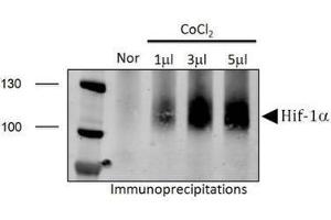 Image no. 5 for anti-Hypoxia Inducible Factor 1, alpha Subunit (Basic Helix-Loop-Helix Transcription Factor) (HIF1A) (AA 432-528) antibody (ABIN363317) (HIF1A 抗体  (AA 432-528))