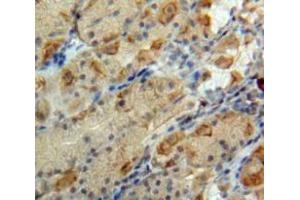 Used in DAB staining on fromalin fixed paraffin-embedded Stomach tissue (Glucagon 抗体  (AA 21-180))