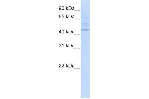 WB Suggested Anti-LAX1 Antibody Titration:  0. (LAX1 抗体  (Middle Region))