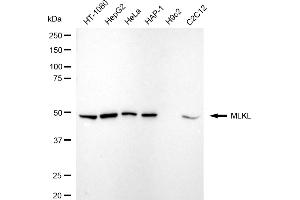 Western blotting analysis using MLKL antibody (ABIN7799481).