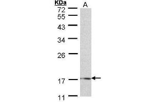 WB Image Sample (30 ug of whole cell lysate) A: 293T 12% SDS PAGE antibody diluted at 1:500 (LMO1 抗体)
