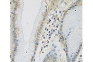 Immunohistochemistry of paraffin-embedded Human stomach using CCL26 Polyclonal Antibody at dilution of 1:200 (40x lens). (CCL26 抗体)