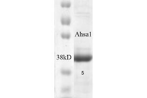 SDS-PAGE of native human 38 kDa Aha1 protein (ABIN1686714, ABIN1686715 and ABIN1686716). (AHSA1 蛋白)