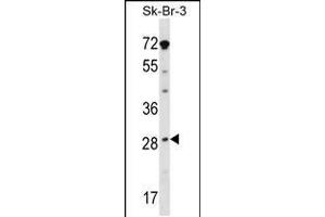 Western blot analysis in SK-BR-3 cell line lysates (35ug/lane). (STAR 抗体  (AA 88-117))