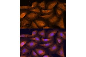 Immunofluorescence analysis of U-2 OS cells using  antibody (ABIN7265407) at dilution of 1:100. (ATF5 抗体)