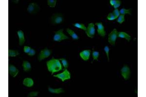 Immunofluorescence staining of MCF-7 cells with ABIN7151584 at 1:200, counter-stained with DAPI. (ELP4 抗体  (AA 117-223))