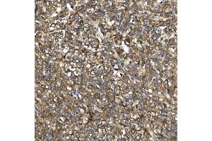 IHC analysis of PDE6 beta/PDE6B using anti-PDE6 beta/PDE6B antibody (ABIN7600894).