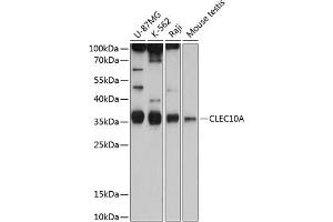 Western blot analysis of extracts of various cell lines, using CD301/CLEC10A antibody (ABIN6130073, ABIN6138696, ABIN6138697 and ABIN6215492) at 1:1000 dilution. (CLEC10A 抗体  (AA 60-180))