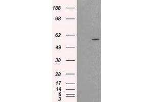 HEK293T cells were transfected with the pCMV6-ENTRY control (Left lane) or pCMV6-ENTRY AKT2 (Right lane) cDNA for 48 hrs and lysed. (AKT2 抗体)