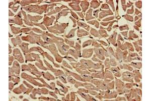 Immunohistochemistry of paraffin-embedded human heart tissue using ABIN7167819 at dilution of 1:100 (RAI1 抗体  (AA 617-823))