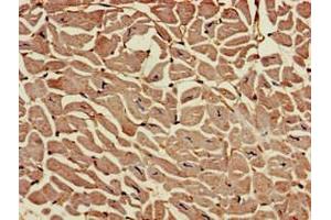 Immunohistochemistry of paraffin-embedded human heart tissue using ABIN7167819 at dilution of 1:100 (RAI1 抗体  (AA 617-823))