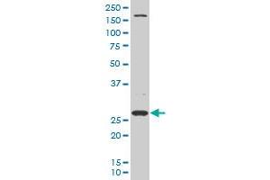 DCUN1D1 polyclonal antibody (A01), Lot # 060524JCS1 Western Blot analysis of DCUN1D1 expression in Hela S3 NE .