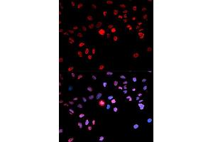 Immunofluorescence analysis of MCF7 cell using Phospho-CREB1-S133 antibody. (CREB1 抗体  (pSer133))